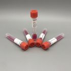 VTM Disposable Virus Sampling Kit Flocked Nylon Nasal Throat Swab